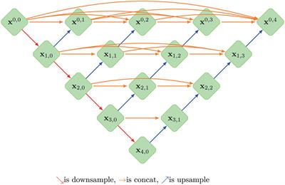Multiple U-Net-Based Automatic Segmentations and Radiomics Feature Stability on Ultrasound Images for Patients With Ovarian Cancer